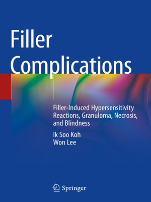 cover image of Filler Complications